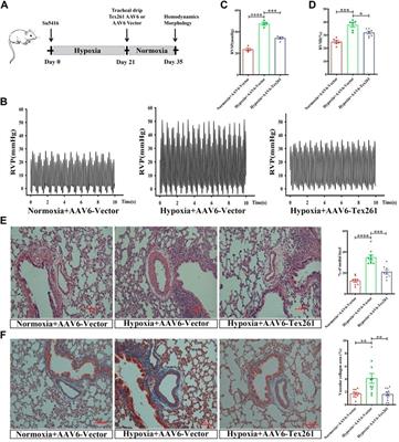 Supplementation with Tex261 provides a possible preventive treatment for hypoxic pulmonary artery hypertension